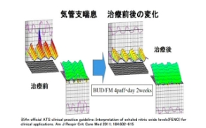 総合呼吸抵抗測定装置（MostGraph）